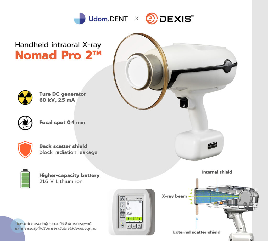 Handheld intraoral Xray Nomad Pro 2™ Udom